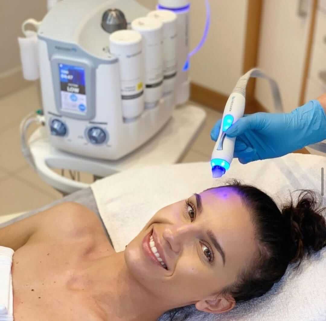 Negovana koža posle Hydrafacial tretmana