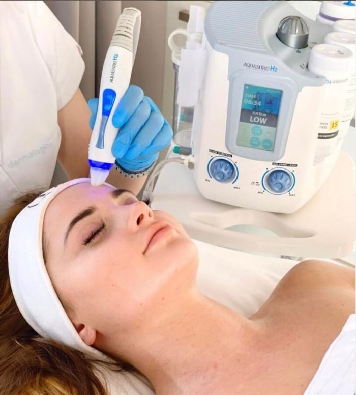 Rezultati pre i posle Hydrafacial tretmana